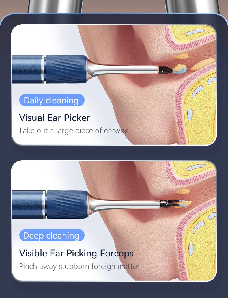 12MP Ear Wax Removal Tool with HD Camera Ear Cleaner with Tweezers Wireless Earwax Cleaner Tool with 6 Ear Spoon Ear Health Care