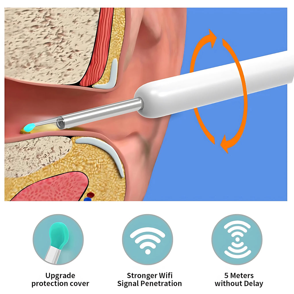 New HD Ear Cleaner with Camera Wireless Ear Sticks Otoscope USB C Charging Endoscope Wax Removal Tool Earpick MIni Camera